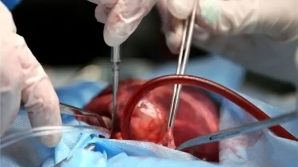 داستان ۲۵۰۰ پیوند یک دکتر ایرانی