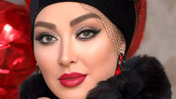 علاقه الهام حمیدی به چهره عروسکی اش / حرف های عجیب خانم بازیگر بعد از جراحی زیبایی!