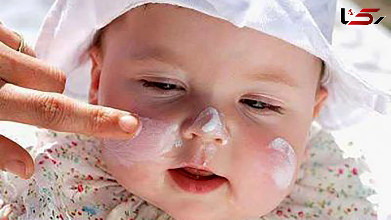 مراقب پوست نوزادان باشید + راهنمایی های لازم
