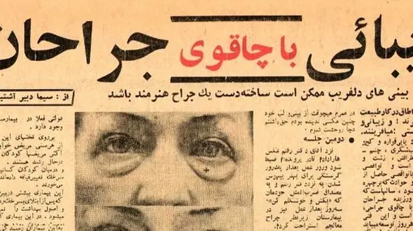 جراحی‌ های زیبایی تهران در ایران قدیم؛ تصاویر نایاب قبل و بعد عمل!