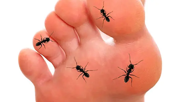 علت گزگز پا چیست؟ + فیلم