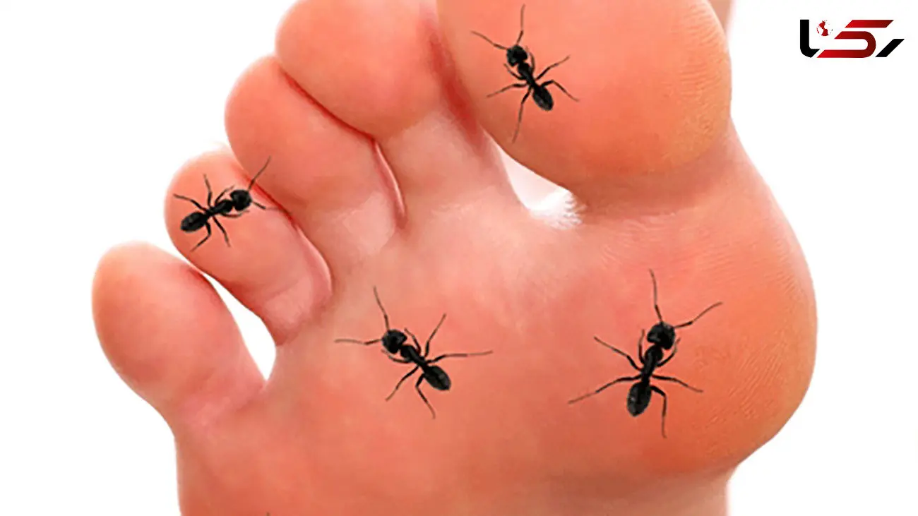 علت گزگز پا چیست؟ + فیلم