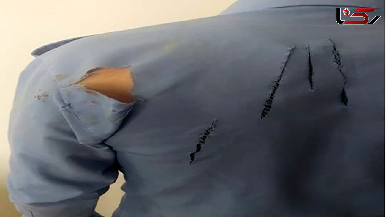 عکس لباس پاره شده مرد واکسیناتور / حمله سگ از پشت سر در ایذه