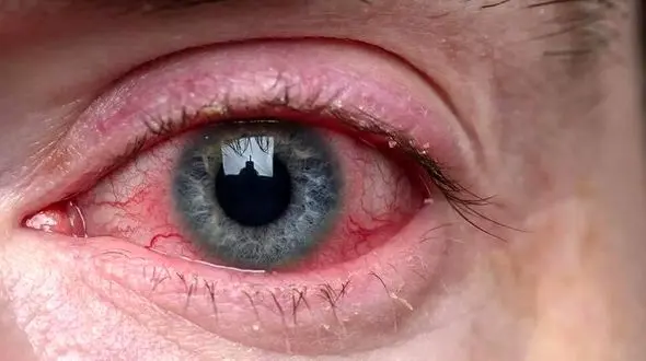 واکنش بدن بیماران خاص به مصرف داروهای ایرانی /دارو‌هایی که بی‌تأثیرند و زمینه ساز بیماری‌های دیگر شدند