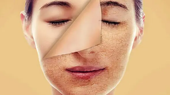 ماسک روغن حیوانی ، دوستدار پوست صورت