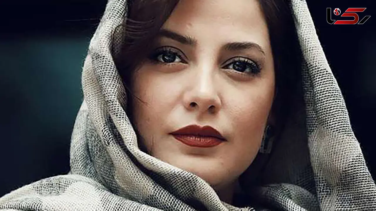 عکس دیده نشده از طناز طباطبایی قبل از عمل زیبایی / باور کردنی نیست ! 