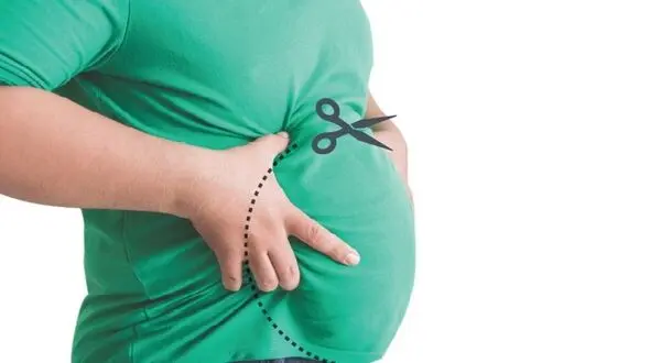 چرا بعد از 40 سالگی لاغری شکم سخت است؟ 