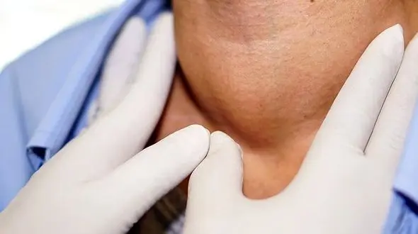 از هر ده نفر یک نفر به بیماری پر کاری تیروئید مبتلاست / زنان 8 برابر مردان مبتلا می شوند/ ابتلا در مناطق کوهستانی ایران بیشتر است