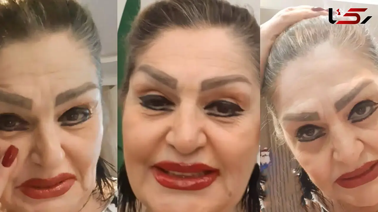 شهناز تهرانی در ایران بود چه شکلی بود ؟! / تصاویر از لاغری اش در جوانی تا عروسی اش و الان در خارج
