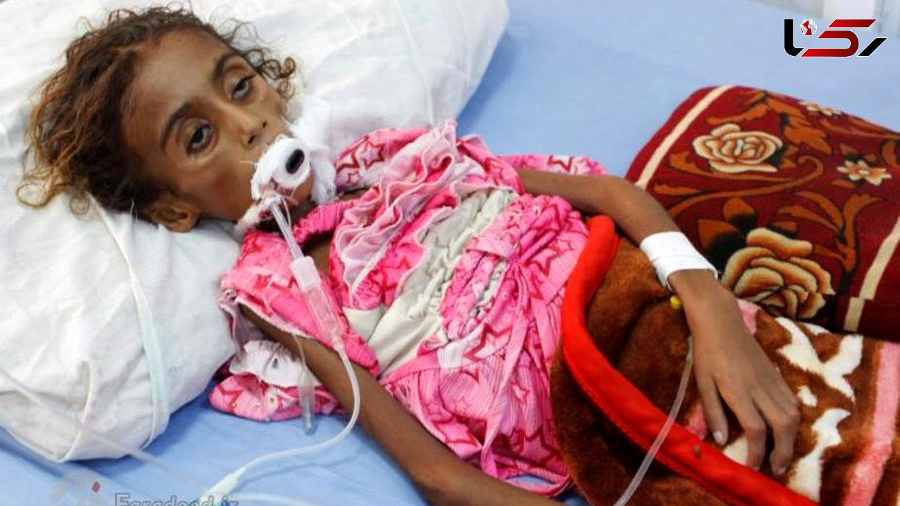 تصویری تکان دهنده از جمیلا دختر یمنی که بر اثر سوءتغذیه از دنیا رفت 