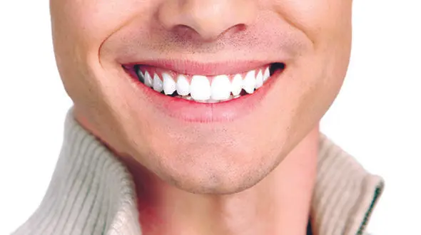 این لبخند ٤٠‌ میلیون تومان آب می خورد! 