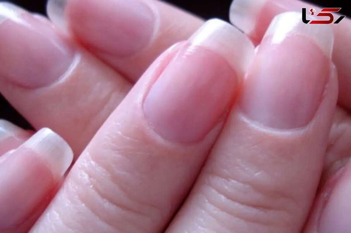 سفر به دنیای میکروسکوپی ناخن‌ها +  فیلم
