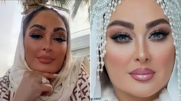 صورت خونی و باورنکردنی الهام حمیدی / چهره پر از عمل و آرایش به چه روزی افتاد!