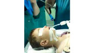 عمل جراحی برای بیرون کشیدن زالو از بدن پسربچه+عکس