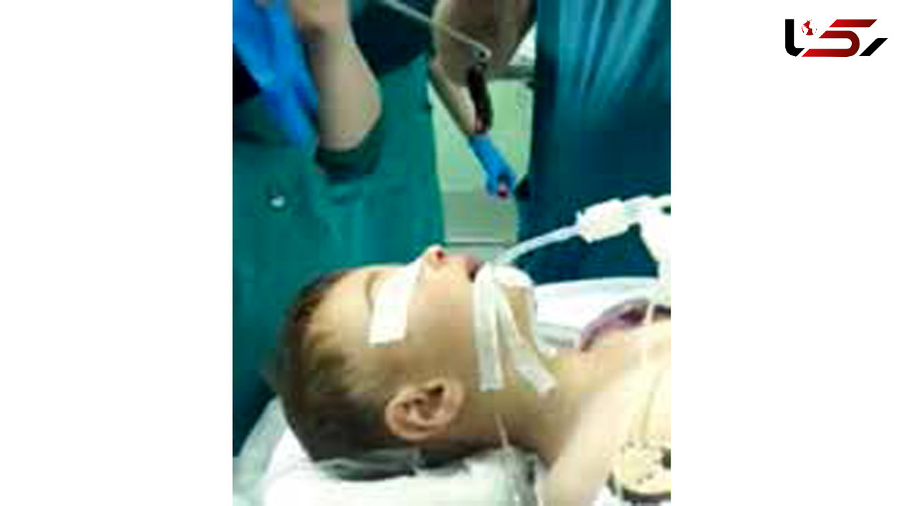 عمل جراحی برای بیرون کشیدن زالو از بدن پسربچه+عکس