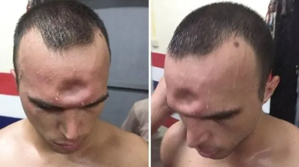 له شدن جمجمه این مرد با یک ضربه + فیلم و عکس باورکردنی