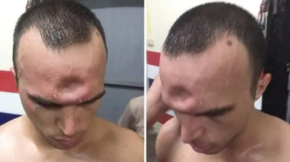 له شدن جمجمه این مرد با یک ضربه + فیلم و عکس باورکردنی
