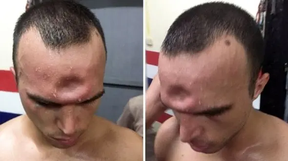 له شدن جمجمه این مرد با یک ضربه + فیلم و عکس باورکردنی