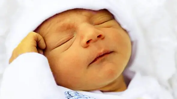 آغوز بهترین تغذیه برای نوزاد است / زردی نوزادان نباید خودسرانه درمان شود