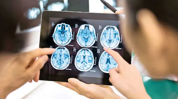 سردرد به خاطر جولان یک کرم +عکس
