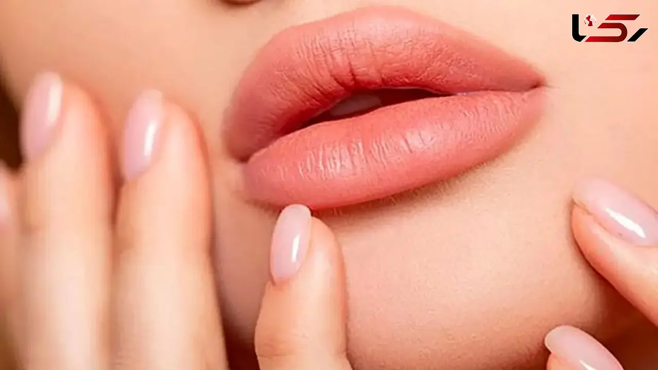 پروتز لب چیست؟ هزینه پروتز لب و مزایا و معایب آن 