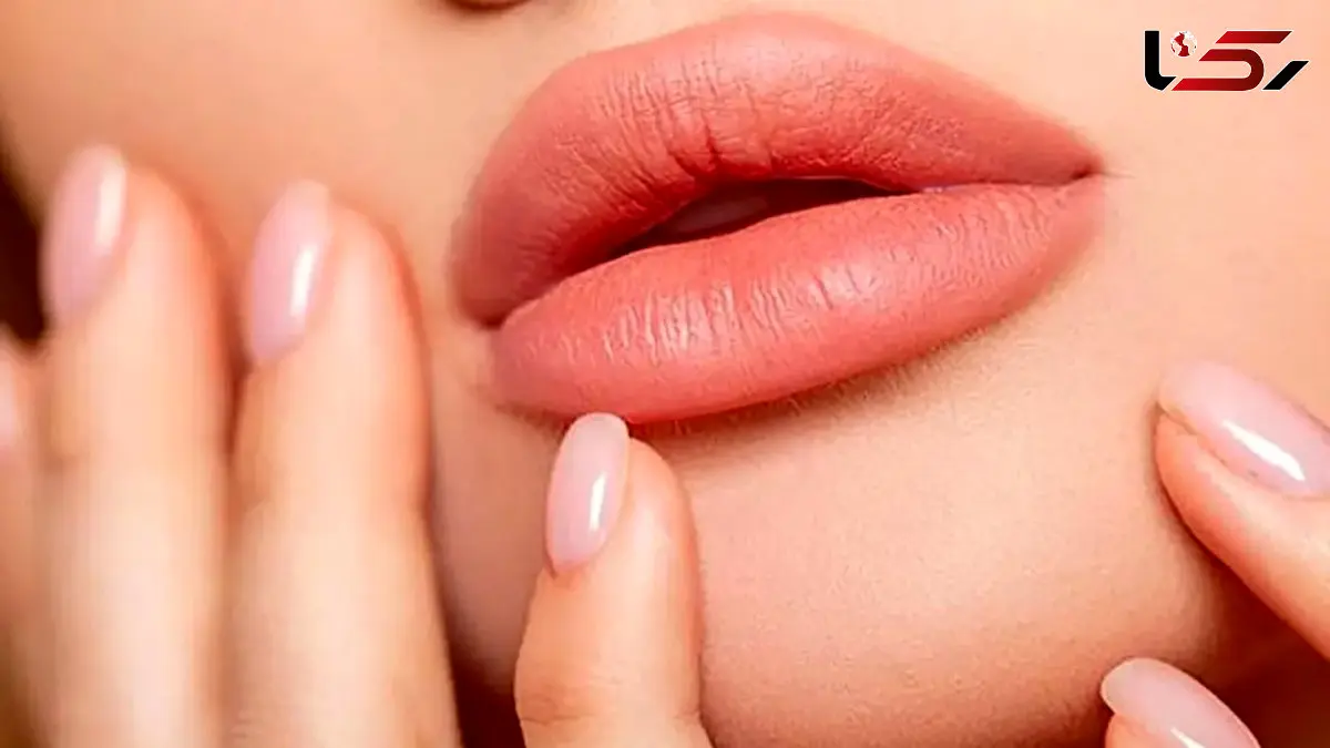 پروتز لب چیست؟ هزینه پروتز لب و مزایا و معایب آن 