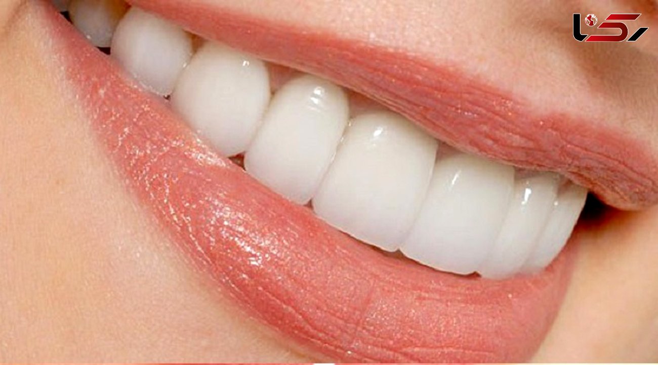 ارتباط طول عمر دندان ها با ارتودنسی