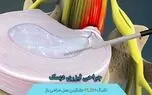  کشف نوین جراح اصفهانی در درمان دیسک با استفاده از لیزر پلاسما / بهبودی 75 درصد مبتلایان + صوت