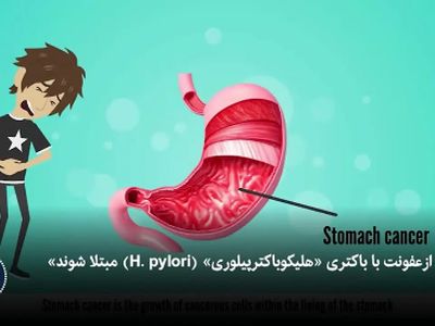 باکتری خطرناک معده: علت اصلی 12 میلیون سرطان + فیلم