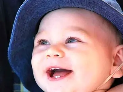 روش مراقبت از دندان‌ های شیری و دائمی کودکان پس از ضربه خوردن