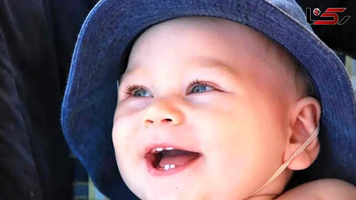 روش مراقبت از دندان‌ های شیری و دائمی کودکان پس از ضربه خوردن