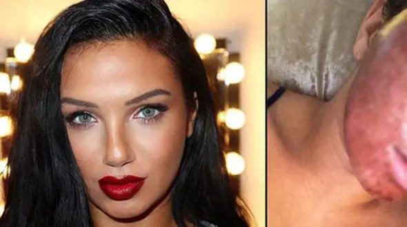 بلایی عجیب که عمل زیبایی بر سر چهره دختر جوان آورد+ تصاویر
