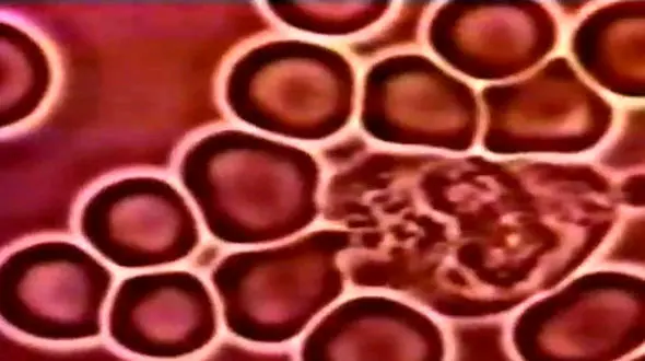 چک کردن سلول ها زیر میکروسکوپ + فیلم