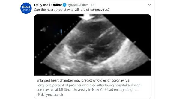 تشخیص مرگ یا زنده ماندن بیمار کرونایی از طریق اسکن قلب + عکس