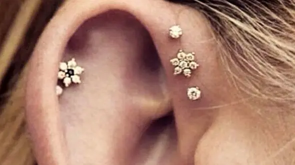 زنانی که سزارین می‌شوند نباید پیرسینگ‌ داشته باشند