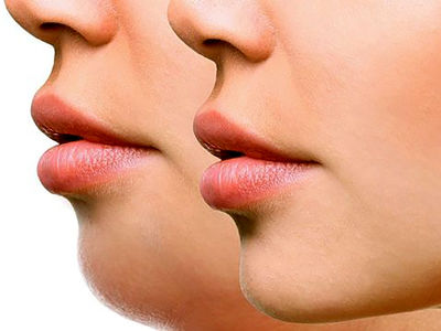 چگونه غبغب خود را کوچک کنیم؟ راهکارهای موثر