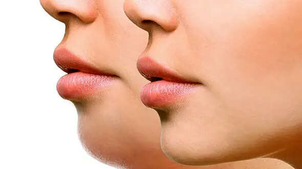 چگونه غبغب خود را کوچک کنیم؟ راهکارهای موثر