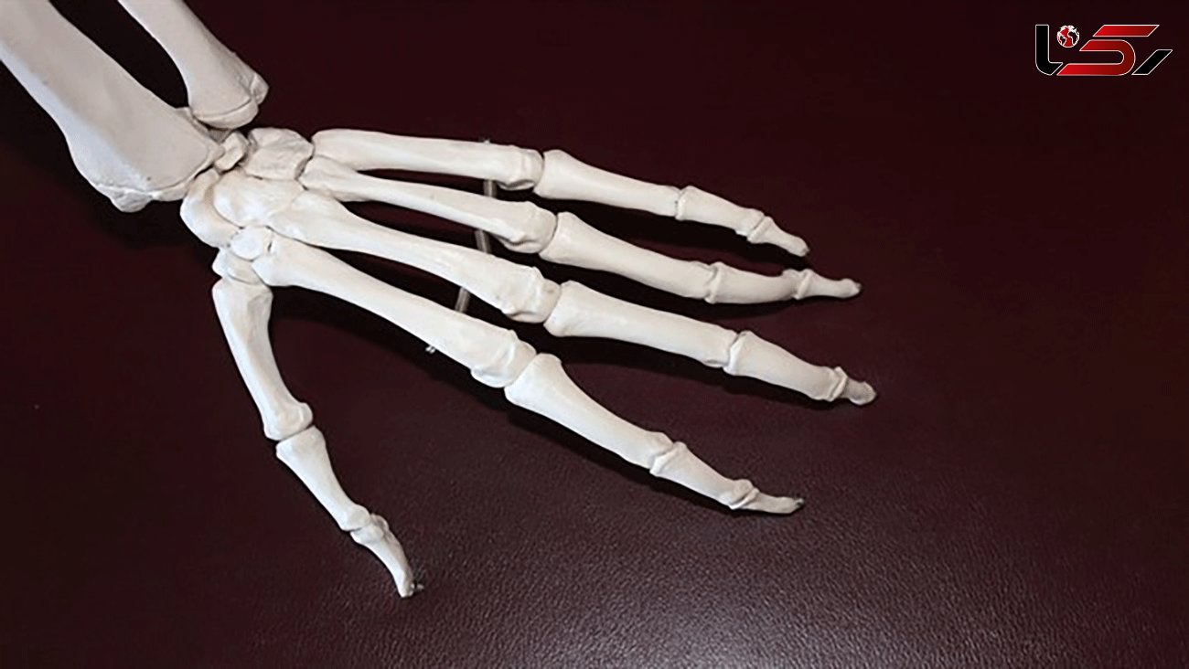 New research predicts whether rheumatoid arthritis patients will respond to treatment
