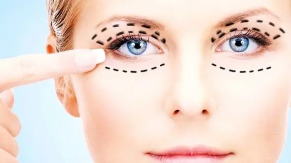 همه روش های برطرف کردن افتادگی پلک