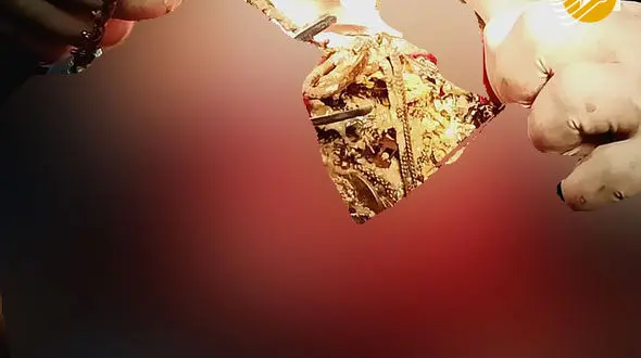 خارج کردن ۱/۵ کیلو طلا از معده زن جوان/ چرا «خاتون» جواهرات فروشگاه برادرش را بلعید؟ + عکس
