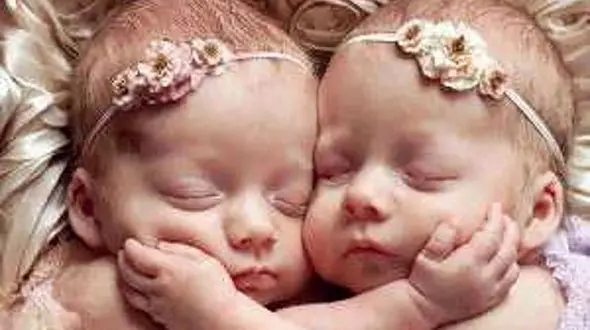 عکس شادترین خواهران به هم چسبیده ! + شیک و لاکچری