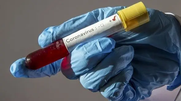 2 مورد مشکوک به کرونا در هرمزگان