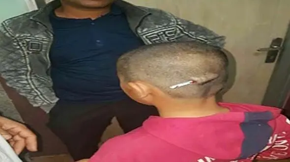 باز هم دانش آموز پسری در مدرسه شکنجه شد+ تصاویر 