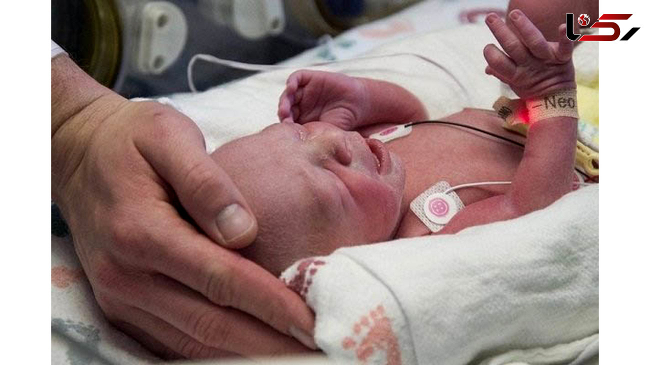 نخستین نوزاد در آمریکا با رحم پیوندی به دنیا آمد