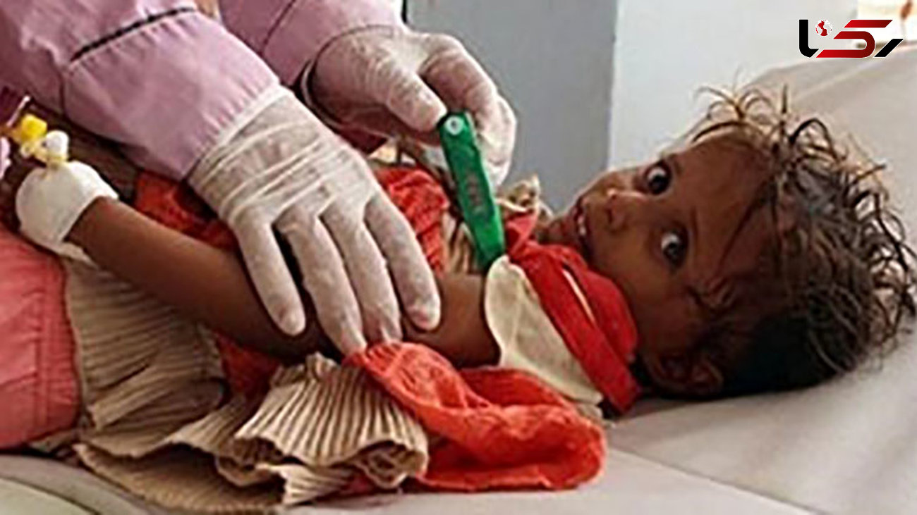 متولد شدن بیش از 3 میلیون کودک از زمان آغاز درگیری‌ها در یمن