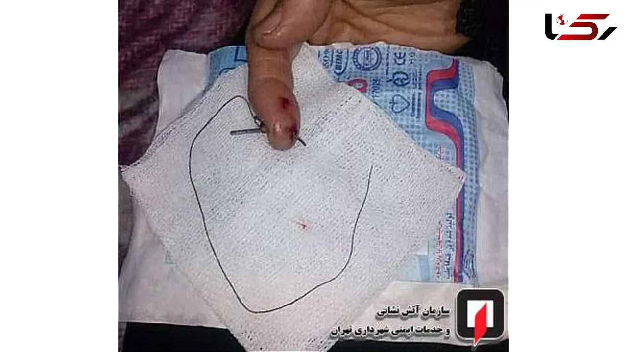 فرو رفتن سوزن چرخ خیاطی در دست زن میانسال + عکس