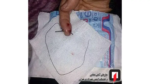 فرو رفتن سوزن چرخ خیاطی در دست زن میانسال + عکس