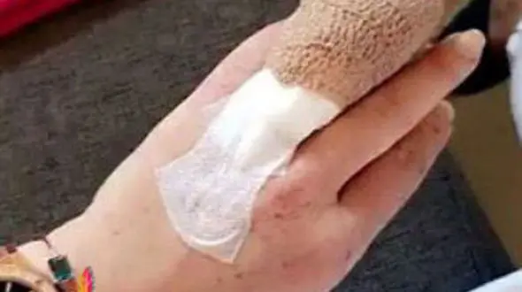 انگشت دست بازیگر زن معروف قطع شد! + عکس