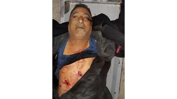  فرمانده حشدالشعبی ترور شد+ عکس پیکر فرمانده / تکذیب شد