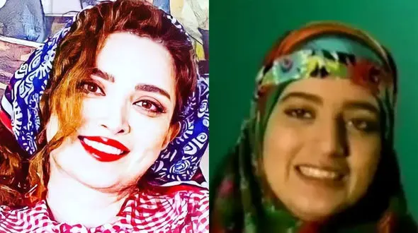 فیلم چهره قبل از عمل زیبایی بهنوش طباطبایی / چقدر تغییر! + عکس ها